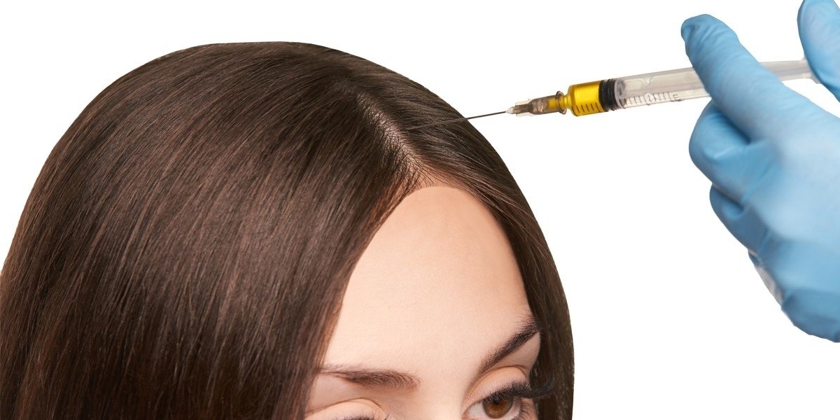 Patient Experiences with Exosomes for Hair Loss in Islamabad